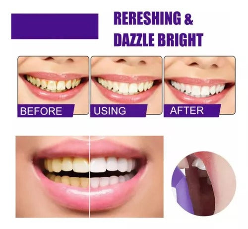 Sérum Blanqueador Dental